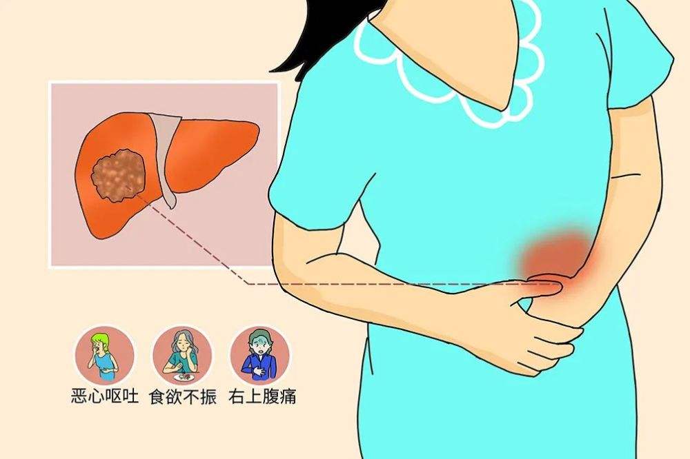 肝血管瘤病人护理怎么做好成都中医肿瘤医院