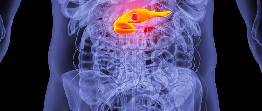 1723876577146857.jpg 摄图网_401863135_人体胰腺癌场景(企业商用).jpg